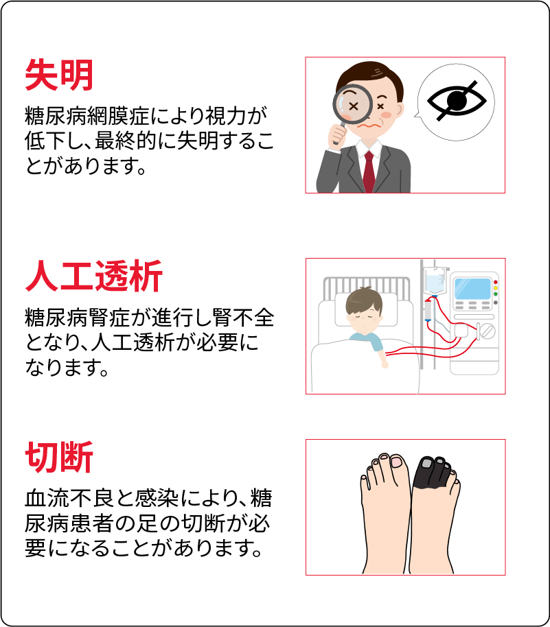 正常な血管 糖尿病の血管