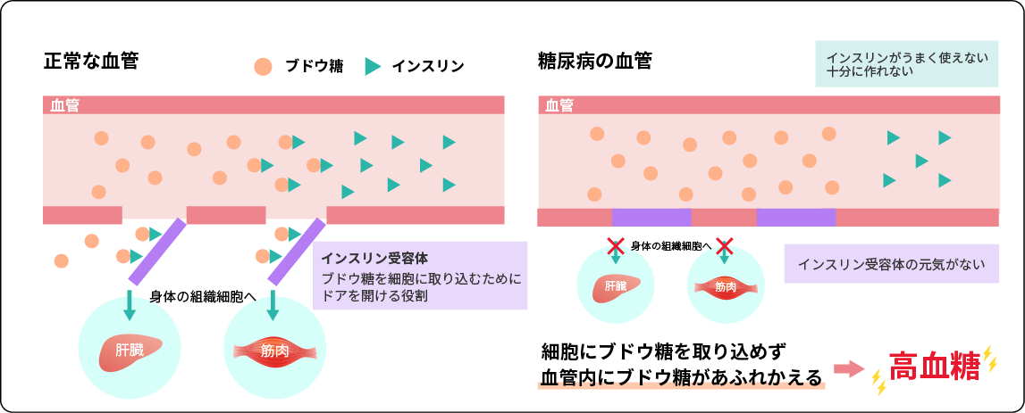 正常な血管 糖尿病の血管