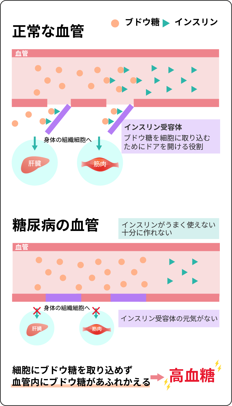 正常な血管 糖尿病の血管